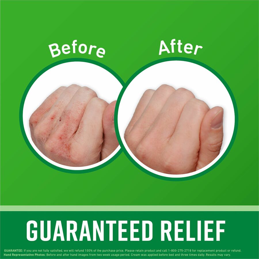 O’Keeffe’s Working Hands Hand Cream: Moisturizing Cream for Dry Cracked Skin - Skin/Body Lotions