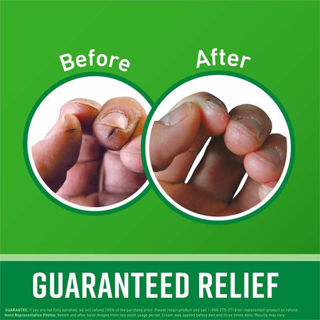 O'Keeffe's Working Hands Hand Cream - Alternate-Image7